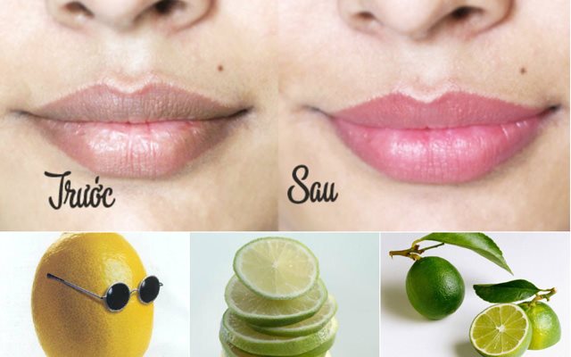 9 cách trị môi thâm hiệu quả